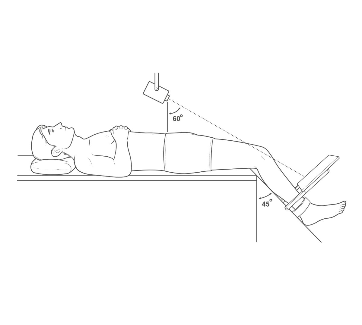 Illustration of axial skyline or Merchant view of the patella area.