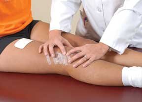 patellar mobilization exercise