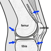 adhesions.png