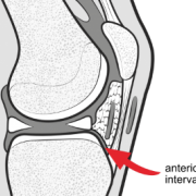 anterior interval