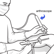 surgeon holding arthroscope