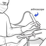 arthroscope_0.png
