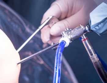 arthroscopic surgery