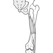 biceps femoris tendinitis