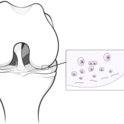 cartilage