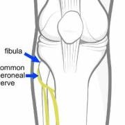 Illustration of the knee joint, showing the position of the sciatic nerve