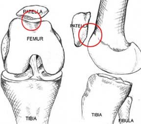 Illustration of patellofemoral compartment