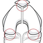 illustration of a knee joint showing the three 'compartments'.