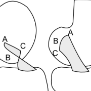 Complex fibre arrangement