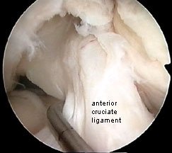cruciate ligament