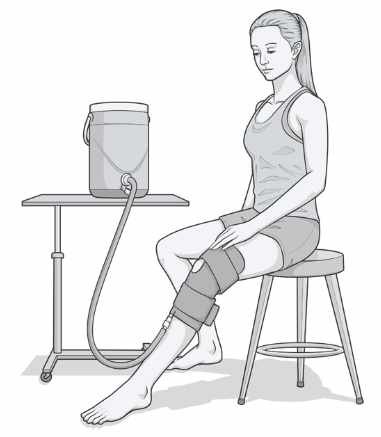 cryocuff.jpg