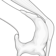 suprapatellar pouch filled with fluid
