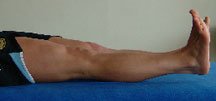 Patient lying on their back with the legs extended.