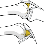 fat pad and its relationship to the ligamentum mucosum