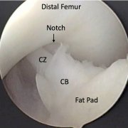 figure_4c.png