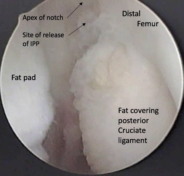 figure_4f.png