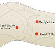 Gerdy's tubercle