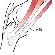 gracilis