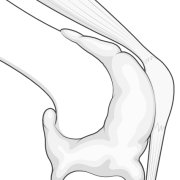 haemarthrosis.png