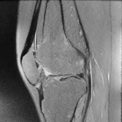 hc-patella-baja_400x400.jpg