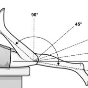 hyperextension_0.png