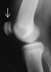 x ray of knee
