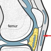 infrapatella-bursa.png