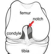 Illustration of front of knee, showing the intercondylar notch.