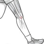 Attachment of iliotibial band at Gerdy's tubercle