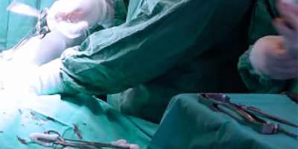 knee-surgery