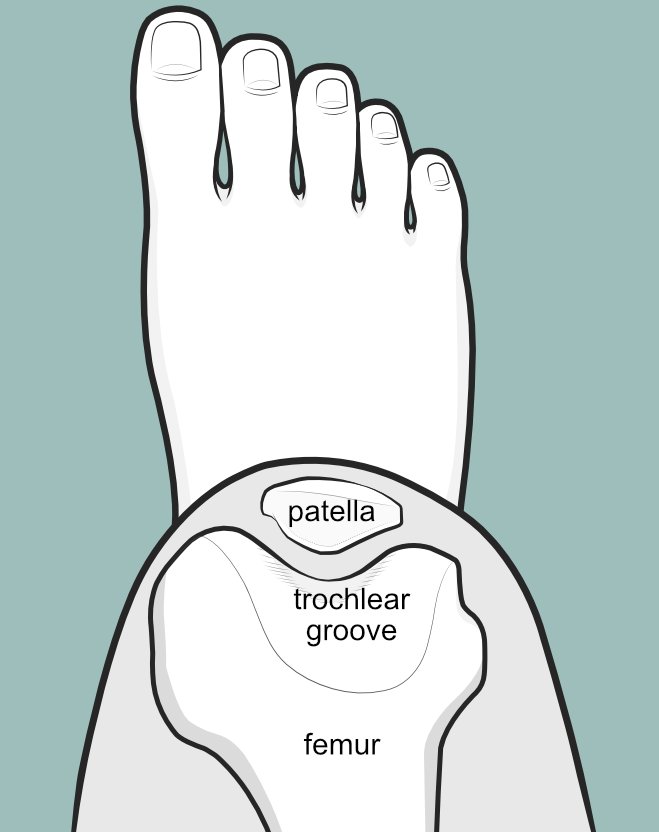 Illustration of the patellofemoral joint, as if the patient were looking down at their own knee.