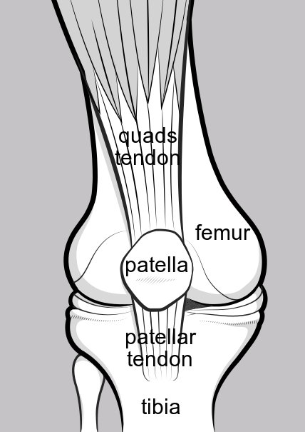 Upright knee