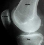 Lateral X-ray of the knee to show how the Blumensaat's line is easy to visualise as long as the two condyles overlap one another.