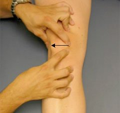 lateral glide