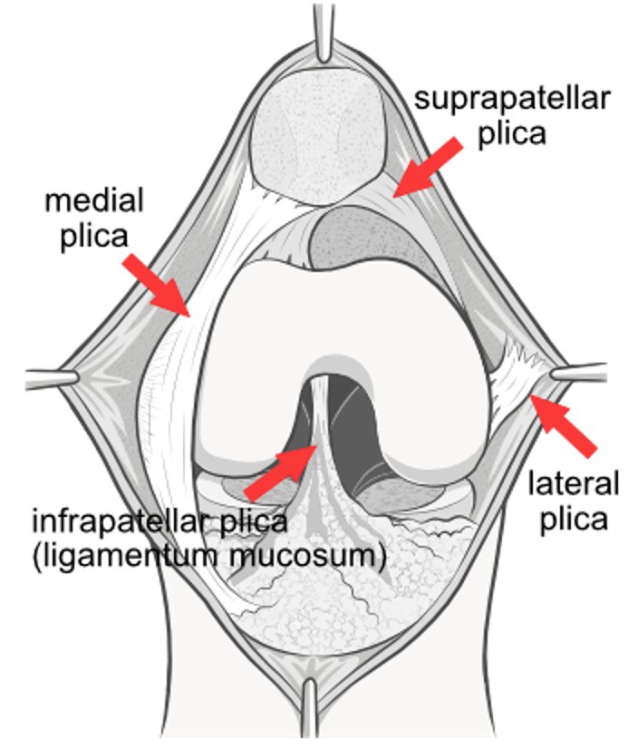 Illustration of the front of the knee opened up to show the ligamentum mucosum arising from the fat pad area.