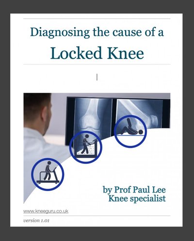 Illustration of front cover of Professor Paul Lee's eBook - Diagnosing the cause of a locked knee.