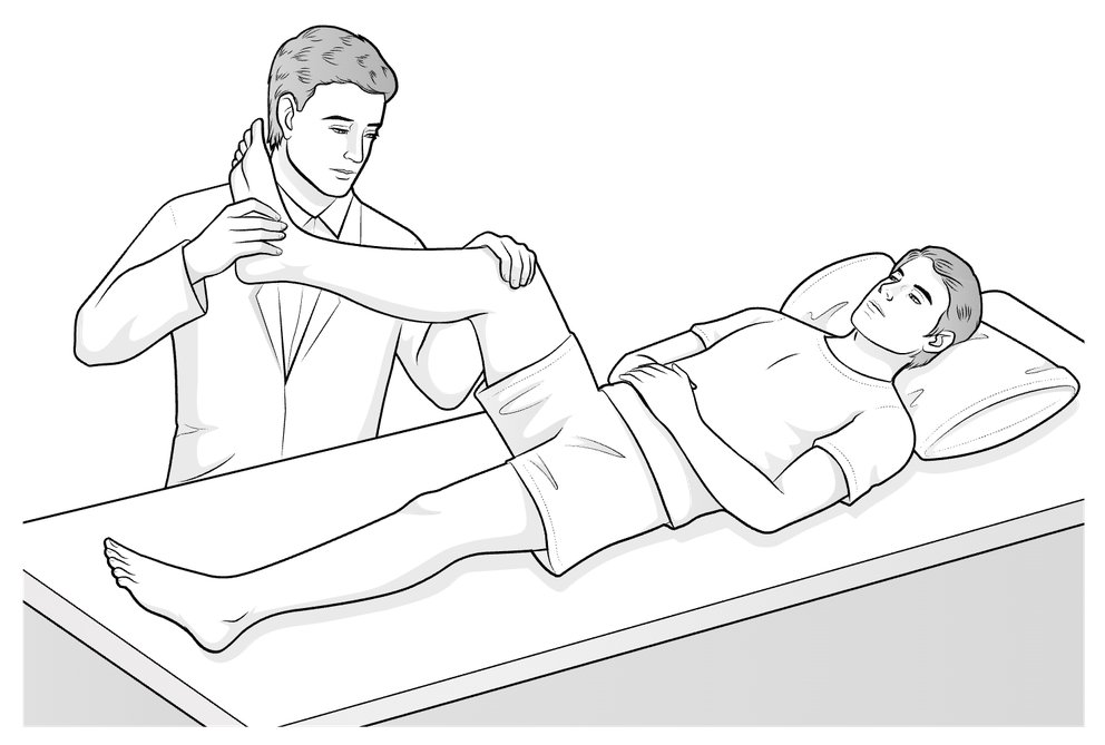 Illustration of a surgeon performing the McMurray test on a supine patient, with one hand on the bent knee and the other twisting the lower leg.