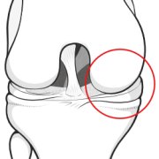 medial-compartment.png