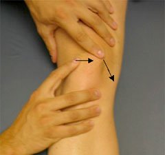 Medial glide and tilt