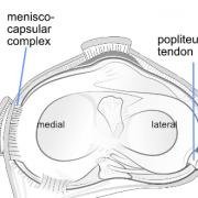 medial versus lateral meniscus