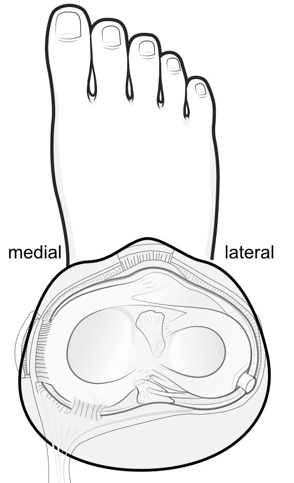 Illustration looing down on the top of the tibial from above, to show how the menisci are situated.