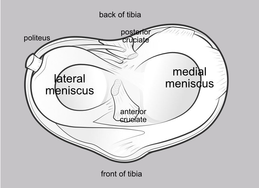 Illustration of the top of the tibia, showing the two menisci seated in place on the top of the tibial plateau.
