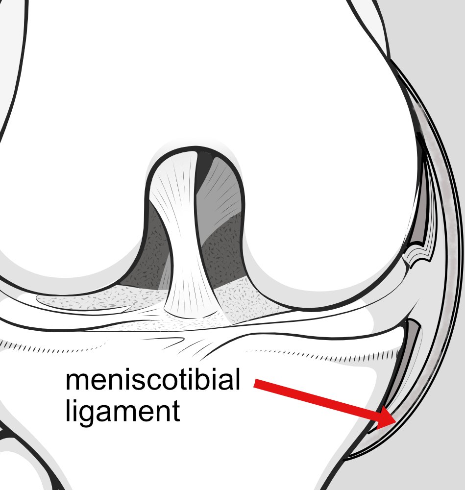 Illustration of the junction of the knee capsule and tibia, anchoring the meniscus.