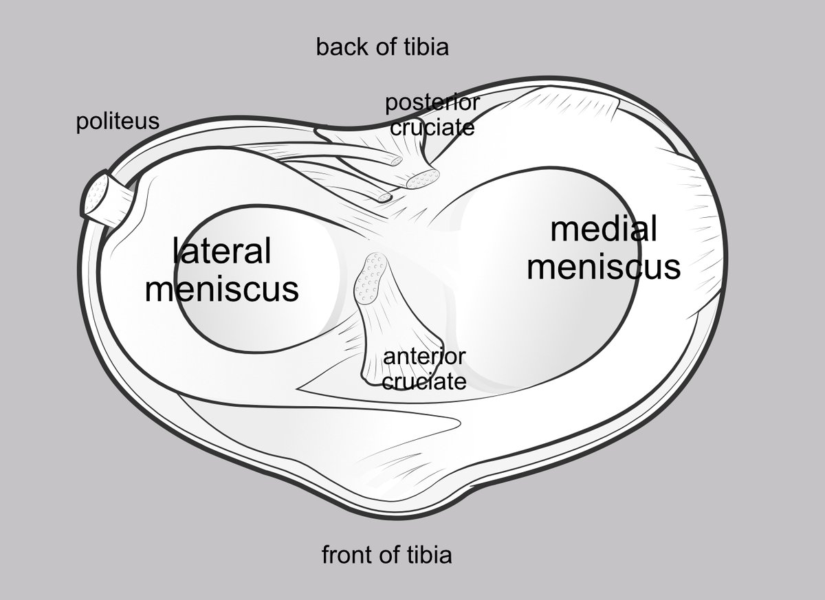 Illustration showing the different shapes of the lateral and medial menisci.