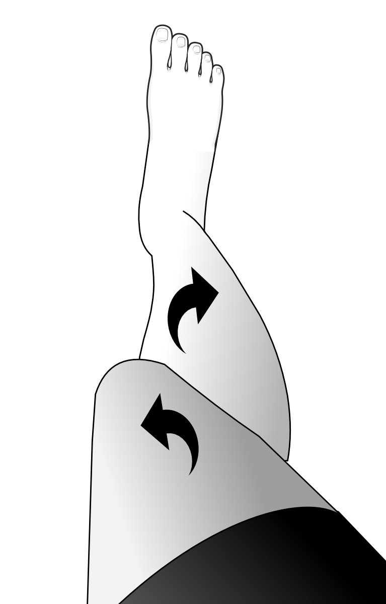 Miserable malalignment