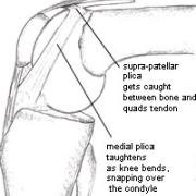 mpp-bent01.jpg