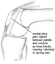 mpp-bent02.jpg