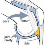 medial plica of the knee