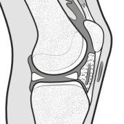 normal-infrapatellar-area.png