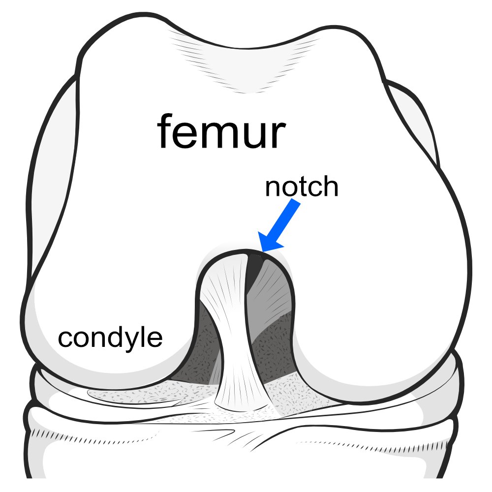 Illustration of the knee joint from the front (knee bent) to show the roof of the notch.